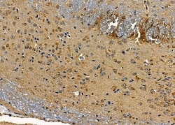 Invitrogen IFNA5 Polyclonal Antibody 100 &mu;L; Unconjugated:Antibodies,