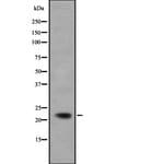 IFNA5 Polyclonal Antibody, Invitrogen™