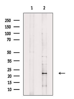 Invitrogen Interferon alpha-6 Polyclonal Antibody 100 &mu;L | Buy Online | Invitrogen&trade; | Fisher Scientific