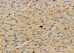 Invitrogen Interferon alpha-8 Polyclonal Antibody 100 &mu;L | Buy Online | Invitrogen&trade; | Fisher Scientific