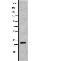 Invitrogen Interferon alpha-8 Polyclonal Antibody 100 &mu;L | Buy Online | Invitrogen&trade; | Fisher Scientific