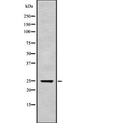 Invitrogen IFNK Polyclonal Antibody 100 &mu;L; Unconjugated:Antibodies,
