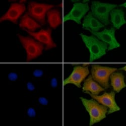 Invitrogen IFIT1B Polyclonal Antibody 100 &mu;L | Buy Online | Invitrogen&trade; | Fisher Scientific
