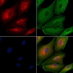 Invitrogen IFIT1B Polyclonal Antibody 100 &mu;L | Buy Online | Invitrogen&trade; | Fisher Scientific