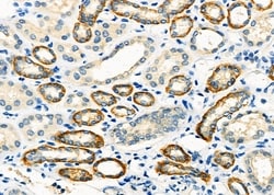 Invitrogen IGFL3 Polyclonal Antibody 100 &mu;L; Unconjugated:Antibodies,