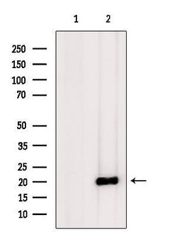 Invitrogen IGFL3 Polyclonal Antibody 100 &mu;L; Unconjugated:Antibodies,
