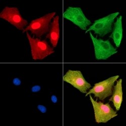 Invitrogen IRGC Polyclonal Antibody 100 &mu;L | Buy Online | Invitrogen&trade; | Fisher Scientific