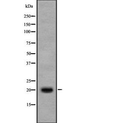 Invitrogen IL17B Polyclonal Antibody 100 &mu;L; Unconjugated:Antibodies,