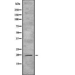 Invitrogen IL-19 Polyclonal Antibody 100 &mu;L; Unconjugated:Antibodies,