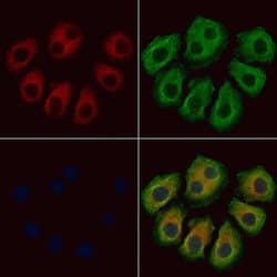 Invitrogen IL-26 Polyclonal Antibody 100 &mu;L | Buy Online | Invitrogen&trade; | Fisher Scientific