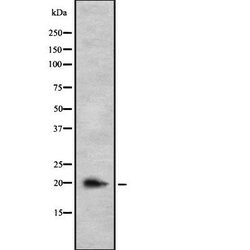 Invitrogen IL-26 Polyclonal Antibody 100 &mu;L | Buy Online | Invitrogen&trade; | Fisher Scientific