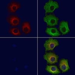Invitrogen IL28B/ IFNL3 Polyclonal Antibody 100 &mu;L; Unconjugated:Antibodies,