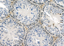 Invitrogen IFI27 Polyclonal Antibody 100 &mu;L; Unconjugated:Antibodies,