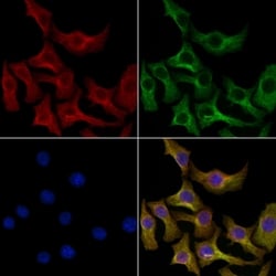 Invitrogen INSIG2 Polyclonal Antibody 100 &mu;L; Unconjugated:Antibodies,