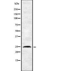 Invitrogen INSIG2 Polyclonal Antibody 100 &mu;L; Unconjugated:Antibodies,