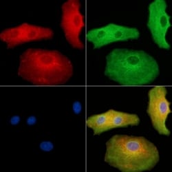 Invitrogen ITGB1BP2 Polyclonal Antibody 100 &mu;L | Buy Online | Invitrogen&trade; | Fisher Scientific