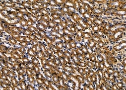 Invitrogen ITGB1BP2 Polyclonal Antibody 100 &mu;L | Buy Online | Invitrogen&trade; | Fisher Scientific