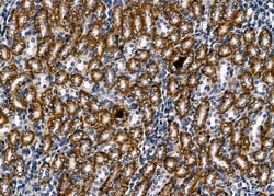 Invitrogen ITGB1BP2 Polyclonal Antibody 100 &mu;L | Buy Online | Invitrogen&trade; | Fisher Scientific