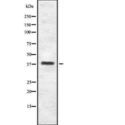 Invitrogen ITGB1BP2 Polyclonal Antibody 100 &mu;L | Buy Online | Invitrogen&trade; | Fisher Scientific