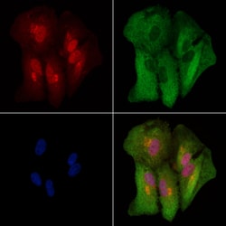 Invitrogen KRT9 Polyclonal Antibody 100 &mu;L; Unconjugated:Antibodies,