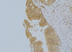Invitrogen KRT9 Polyclonal Antibody 100 &mu;L; Unconjugated:Antibodies,
