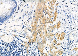 Invitrogen KRT9 Polyclonal Antibody 100 &mu;L; Unconjugated:Antibodies,