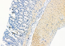 Invitrogen KRT9 Polyclonal Antibody 100 &mu;L; Unconjugated:Antibodies,
