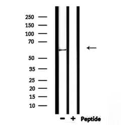 Invitrogen KRT9 Polyclonal Antibody 100 &mu;L; Unconjugated:Antibodies,