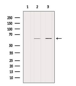 Invitrogen KRT9 Polyclonal Antibody 100 &mu;L; Unconjugated:Antibodies,