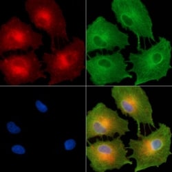 Cytokeratin 35/37/38 Polyclonal Antibody, Invitrogen 100 &mu;L; Unconjugated:Antibodies,
