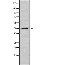 Cytokeratin 35/37/38 Polyclonal Antibody, Invitrogen 100 &mu;L; Unconjugated:Antibodies,