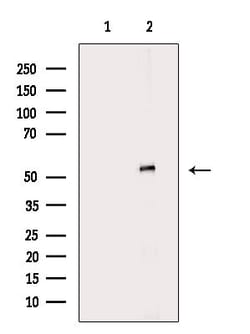Invitrogen KRT83 Polyclonal Antibody 100 &mu;L; Unconjugated:Antibodies,