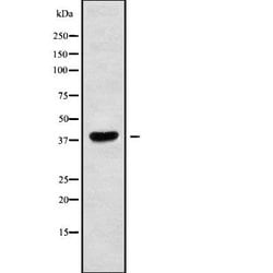 Invitrogen MAGEA10 Polyclonal Antibody 100 &mu;L; Unconjugated:Antibodies,