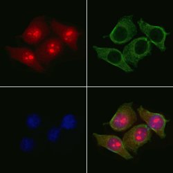 MAGEB4 Polyclonal Antibody, Invitrogen 100 μL; Unconjugated:Antibodies,