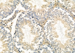 Invitrogen MAGEC3 Polyclonal Antibody 100 &mu;L; Unconjugated:Antibodies,
