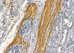 Invitrogen MAGEF1 Polyclonal Antibody 100 &mu;L | Buy Online | Invitrogen&trade; | Fisher Scientific