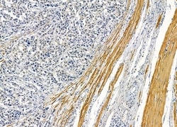 Invitrogen MAGEF1 Polyclonal Antibody 100 &mu;L | Buy Online | Invitrogen&trade; | Fisher Scientific