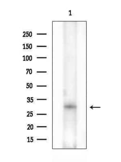 Invitrogen MAGEF1 Polyclonal Antibody 100 &mu;L | Buy Online | Invitrogen&trade; | Fisher Scientific