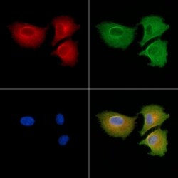 MYL6B Polyclonal Antibody 100 &mu;L | Buy Online | Thermo Scientific | Fisher Scientific