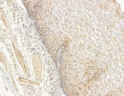 MYL6B Polyclonal Antibody 100 &mu;L | Buy Online | Thermo Scientific | Fisher Scientific