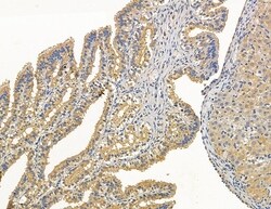 MYL6B Polyclonal Antibody 100 &mu;L | Buy Online | Thermo Scientific | Fisher Scientific