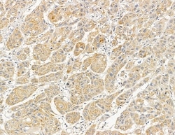 MYL6B Polyclonal Antibody 100 &mu;L | Buy Online | Thermo Scientific | Fisher Scientific