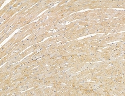 MYL6B Polyclonal Antibody 100 &mu;L | Buy Online | Thermo Scientific | Fisher Scientific