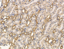 MYL6B Polyclonal Antibody 100 &mu;L | Buy Online | Thermo Scientific | Fisher Scientific