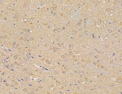 MYL6B Polyclonal Antibody 100 &mu;L | Buy Online | Thermo Scientific | Fisher Scientific