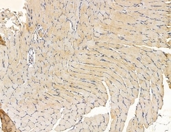 MYL6B Polyclonal Antibody 100 &mu;L | Buy Online | Thermo Scientific | Fisher Scientific