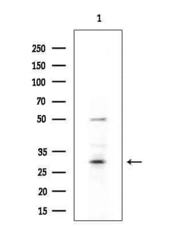 MYL6B Polyclonal Antibody 100 &mu;L | Buy Online | Thermo Scientific | Fisher Scientific