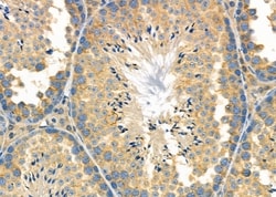 Invitrogen PDCD2L Polyclonal Antibody 100 &mu;L; Unconjugated:Antibodies,