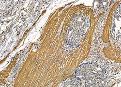 Invitrogen TUBE1 Polyclonal Antibody 100 &mu;L | Buy Online | Invitrogen&trade; | Fisher Scientific