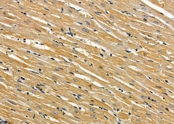 Invitrogen TUBE1 Polyclonal Antibody 100 &mu;L | Buy Online | Invitrogen&trade; | Fisher Scientific